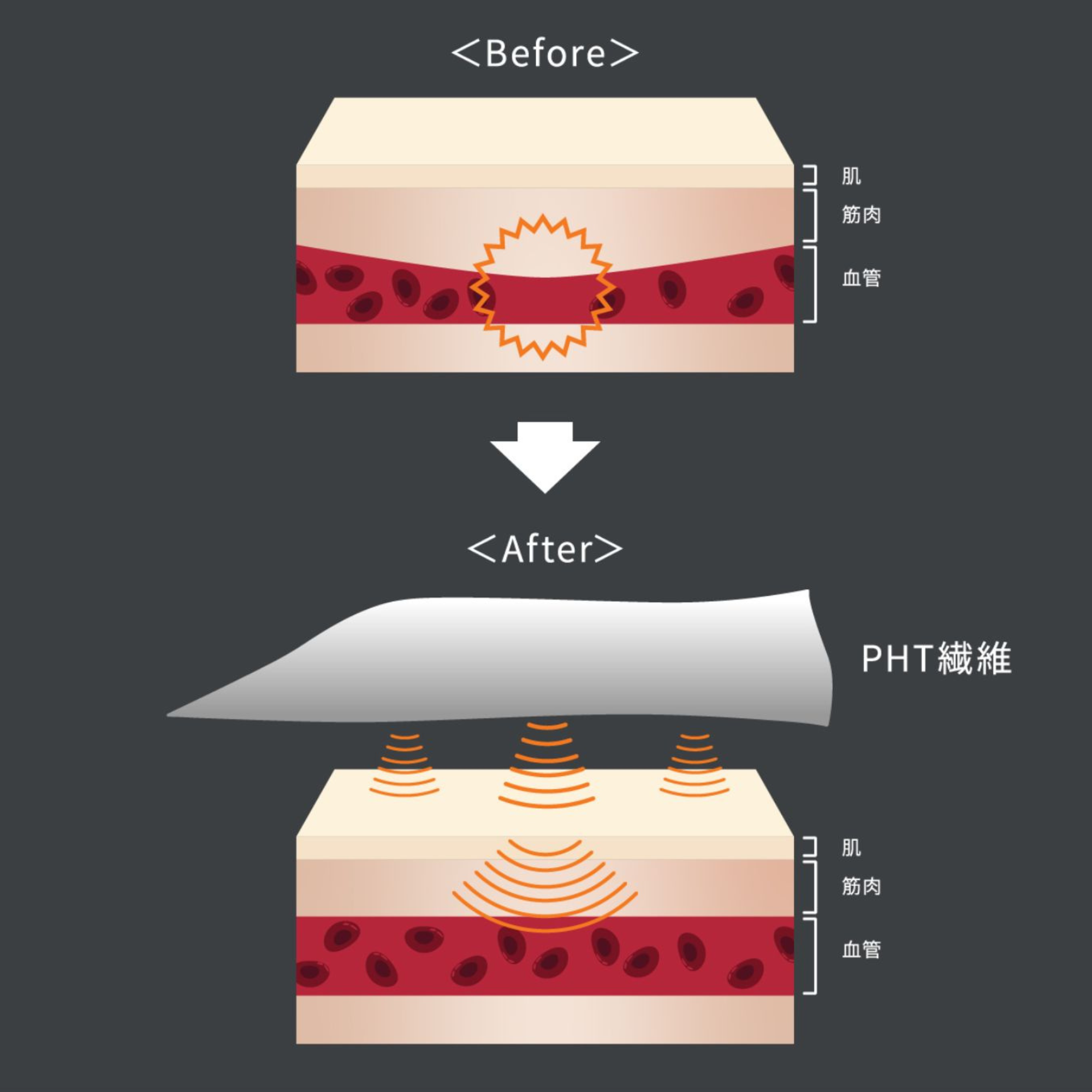 VENEX リカバリークロス+